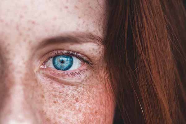 Red Skin? Here Are 3 Common Causes