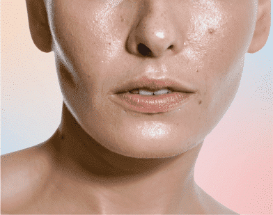 Oily & Acne Prone Skin