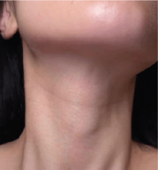 Tech Neck