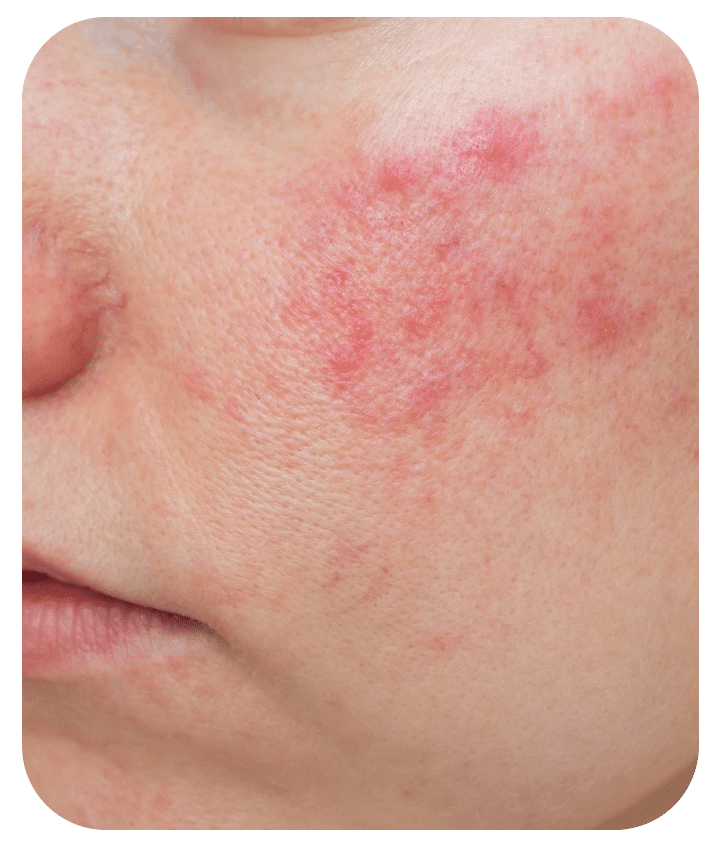 Designed to address Inflammation