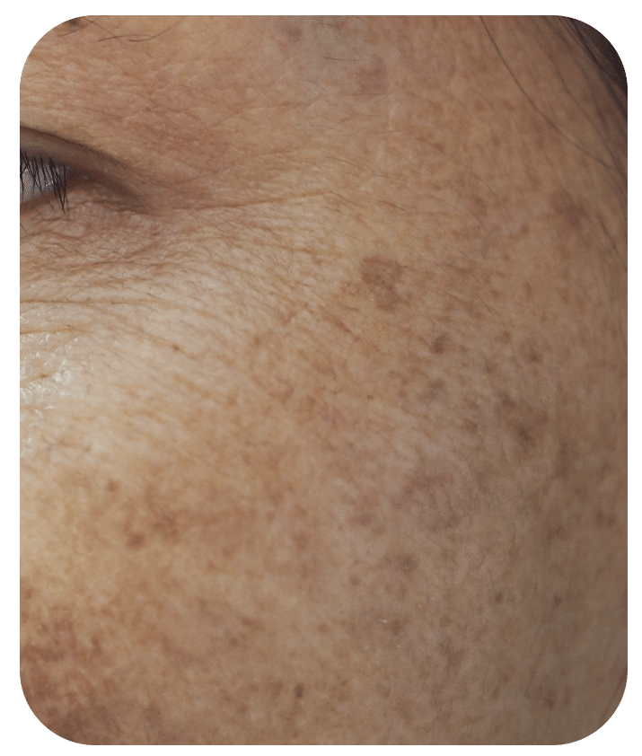 Designed to address PIH