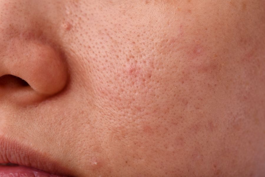 Texture and Pores
